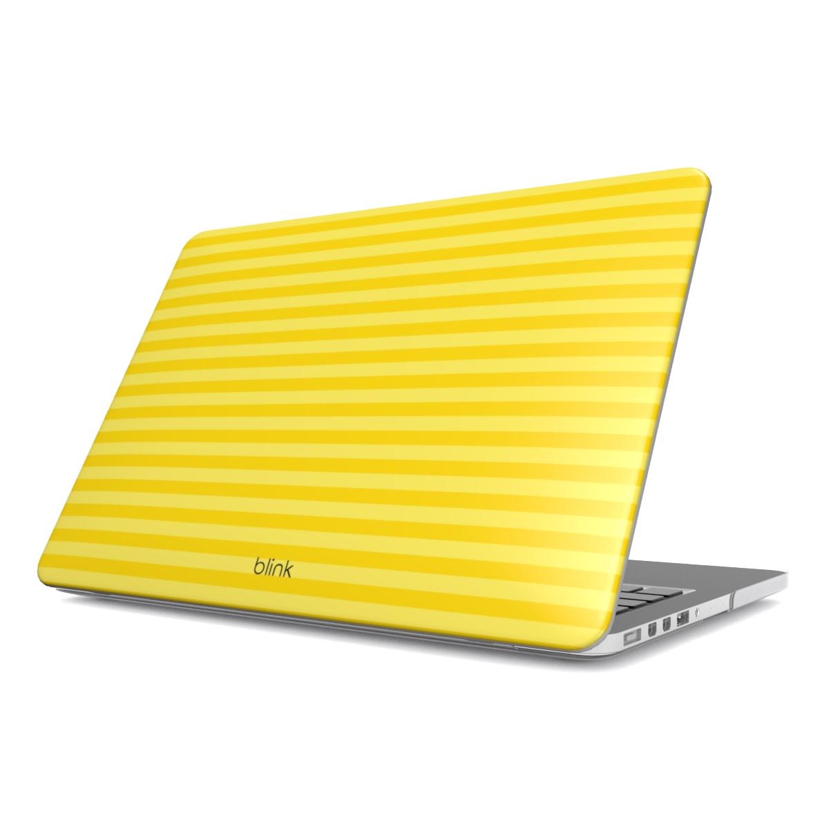 Sunflower Eze MacBook Case