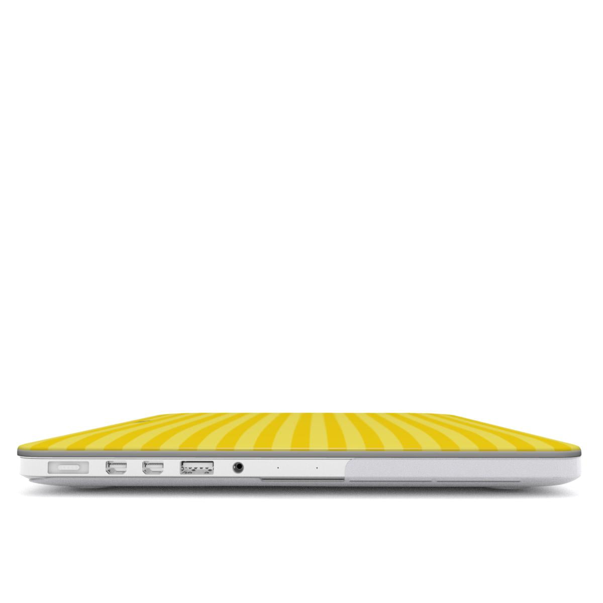 Sunflower Eze MacBook Case