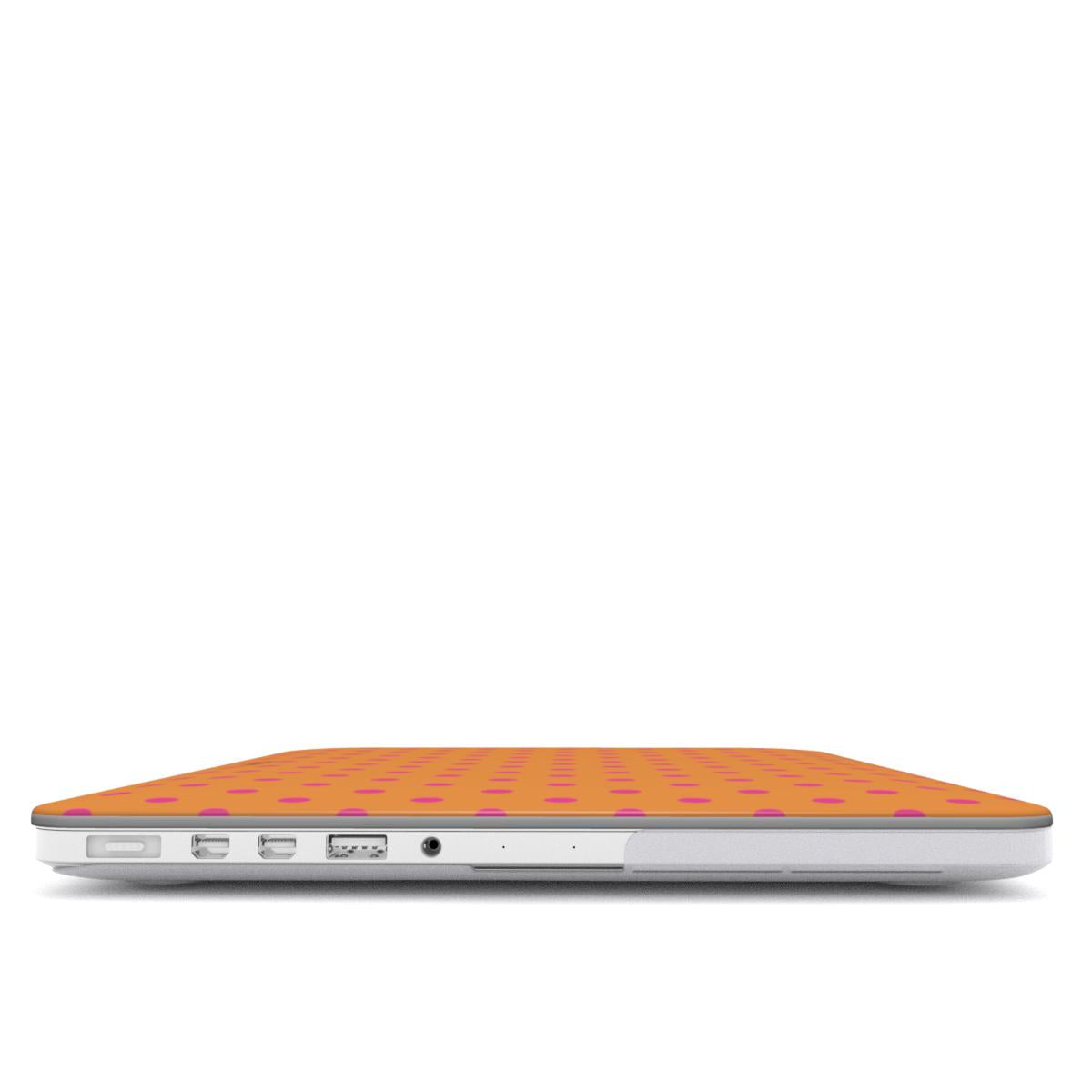 Tropical Oxford MacBook Case