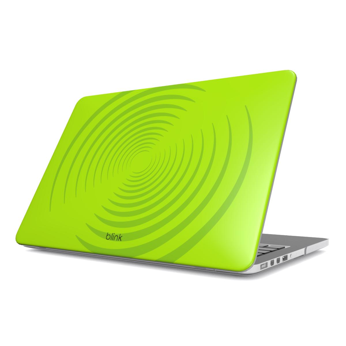 Avocado Galaxy MacBook Case