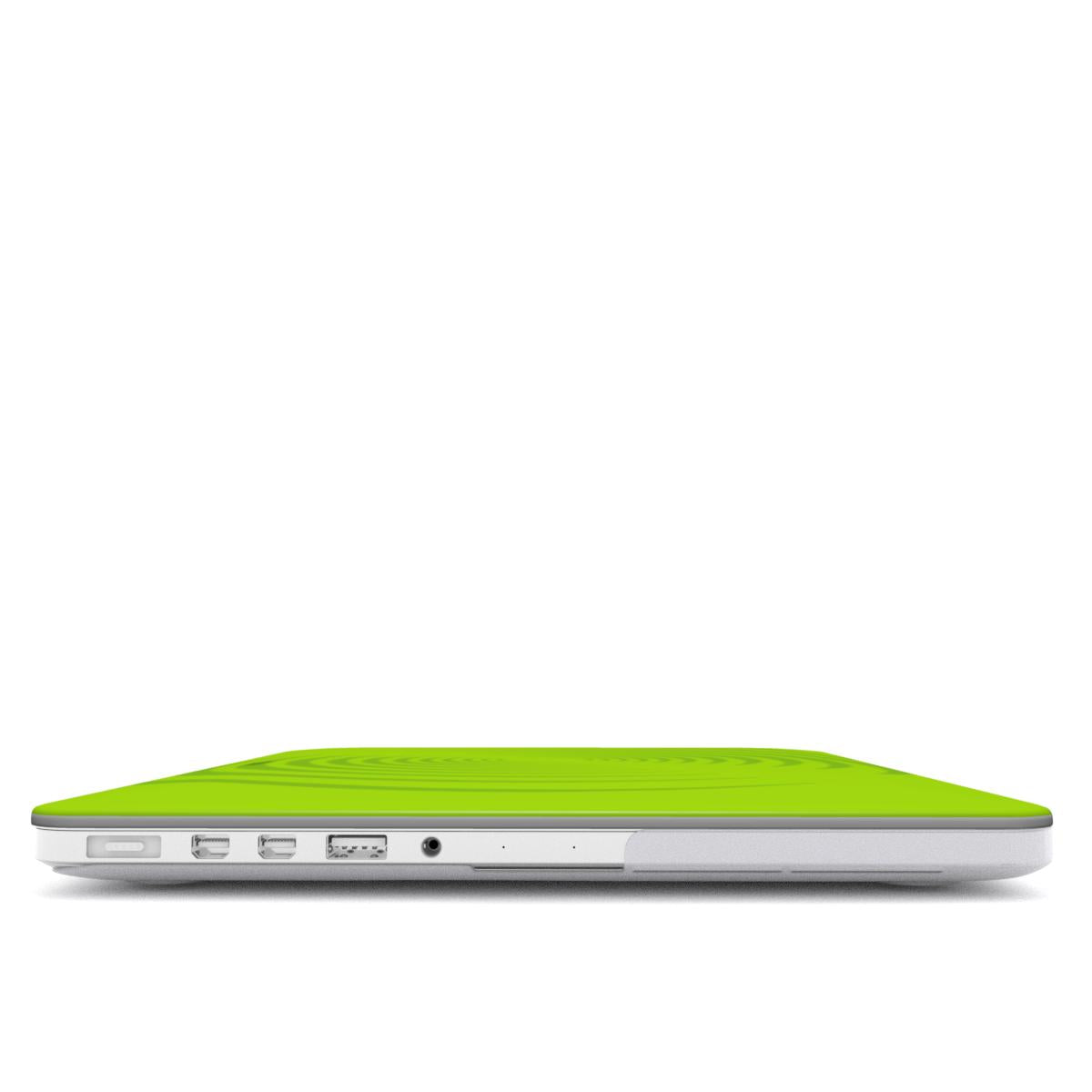 Avocado Galaxy MacBook Case