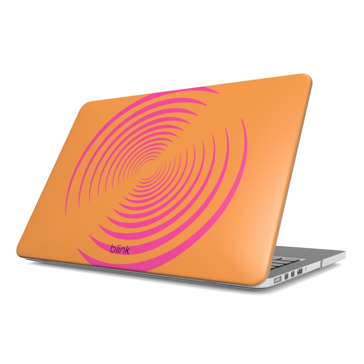 Tropical Galaxy MacBook Case