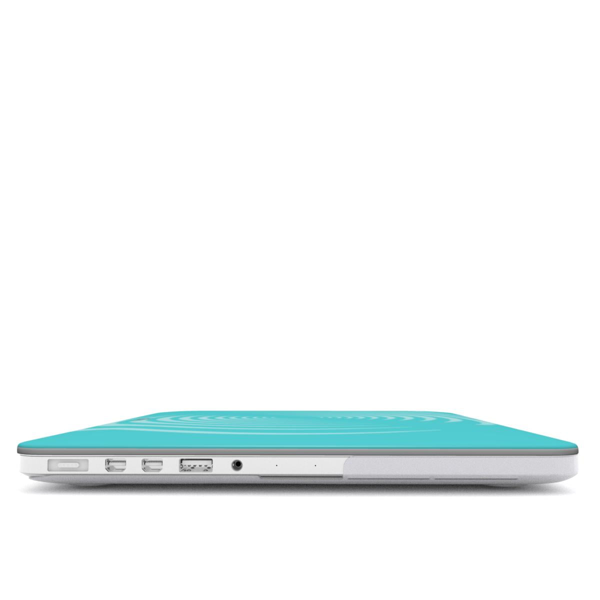 Tiffany Galaxy MacBook Case