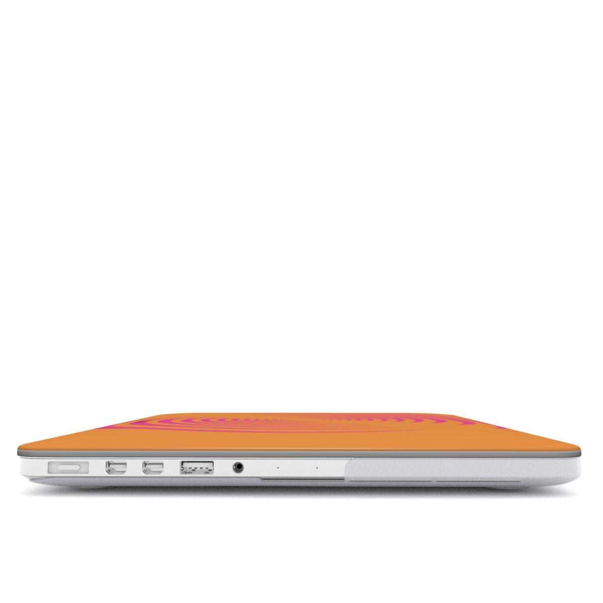 Tropical Galaxy MacBook Case