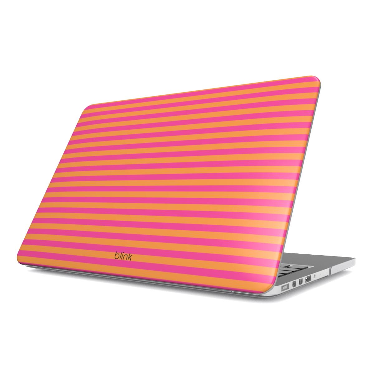 Tropical Eze MacBook Case
