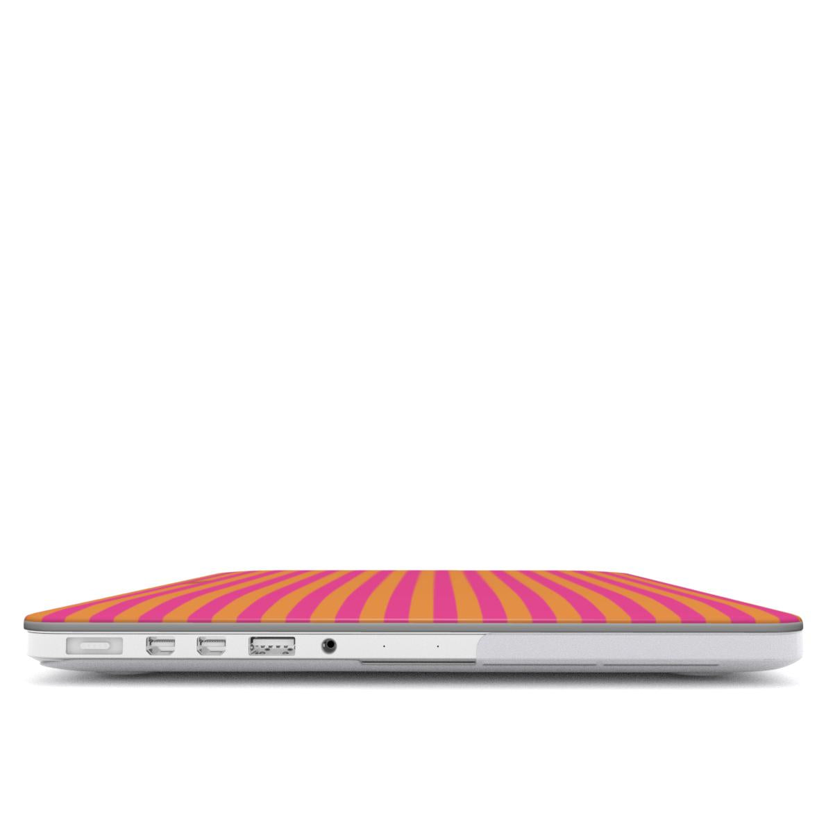 Tropical Eze MacBook Case
