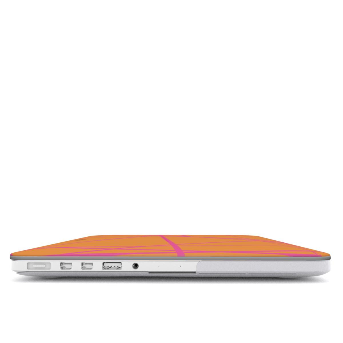 Tropical Geo MacBook Case