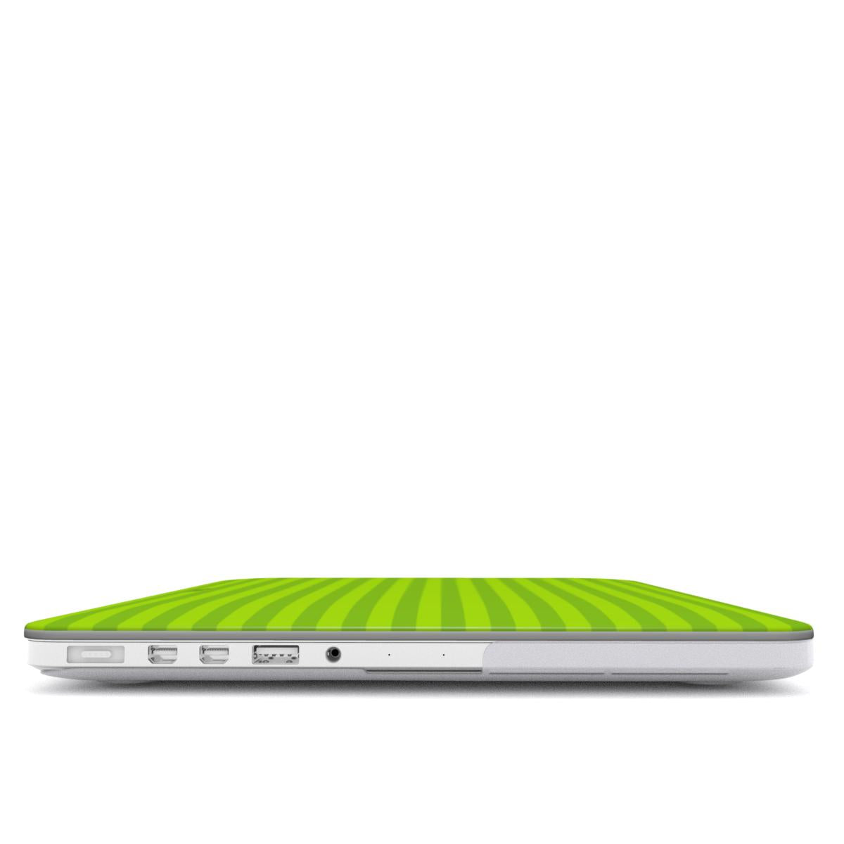 Avocado Eze MacBook Case